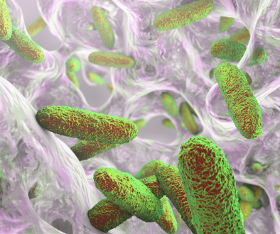 Serrapeptase bei Borreliose